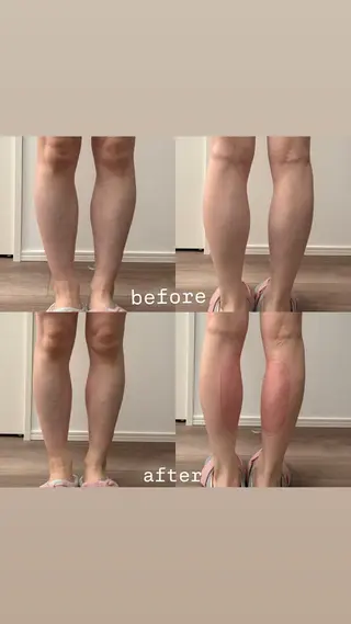 Miiju.所属・Miiju. 石巻市 脂肪冷却  鈴木のエステ・リラクイメージ