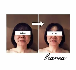 bianca【ビアンカ】所属・bianca 【菌活 温活 小顔】のエステ・リラクイメージ