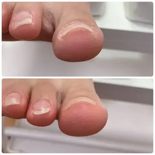 ネイル Alo.nail アロ•ネイルのネイルデザイン