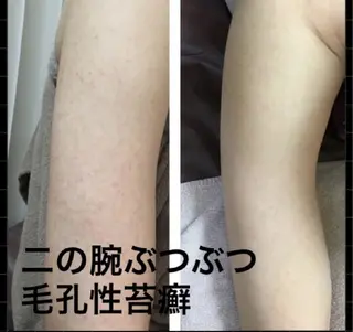 ハーブピーリング専門 COCO.梅田中津のエステ・リラクイメージ