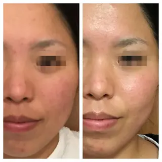 salon.plaisir（プレズィール）所属・酒井 瑠未のエステ・リラクイメージ