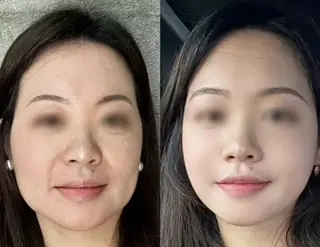 ネイル aliaハイフ&水光ジェットサロン所属・aliaハーブ水光店 エステティシャン募集のエステ・リラクイメージ