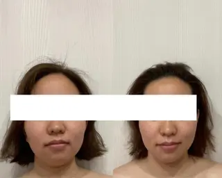 PARAFUSE.札幌店Brange所属・佐藤 陽子のエステ・リラクイメージ