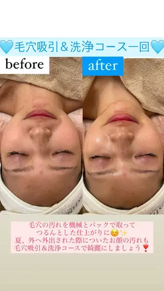 メンズ Salon de Lino 御器所のエステ・リラクイメージ