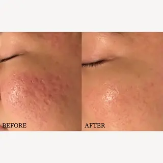 BIB PIBのエステ・リラクイメージ