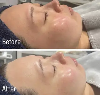 アンド ミルルのエステ・リラクイメージ