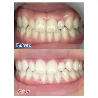 M渋谷店所属・M渋谷 ホワイトニングのエステ・リラクイメージ