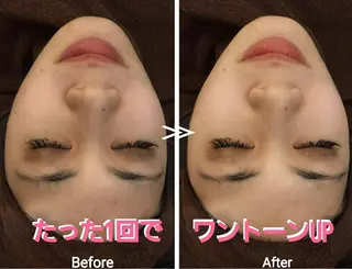 鈴木 琴美のエステ・リラクイメージ