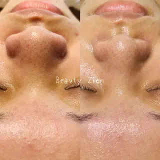 Beauty Zion所属・Beauty Zionのエステ・リラクイメージ