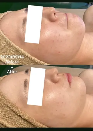 月のあかり所属・オイル&フェイシャル 【月のあかり🌙】のエステ・リラクイメージ