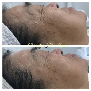 ビューティー ミロワールのエステ・リラクイメージ