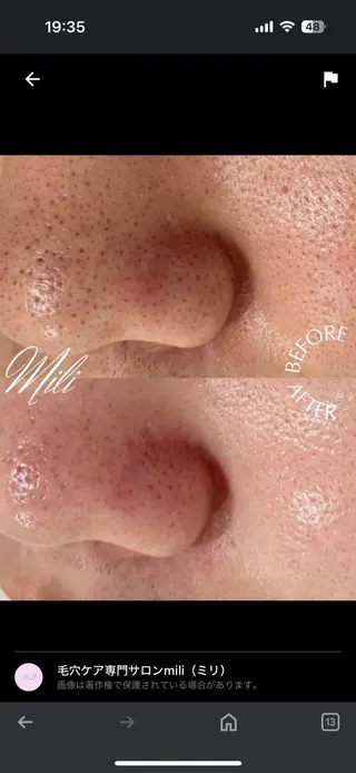 毛穴専門店 mili柏のエステ・リラクイメージ