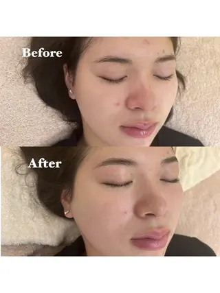 アイブロウ アイブロウサロンMily所属・眉毛/美肌の専門店 Mily🍒ミウィの眉毛・アイブロウイメージ