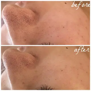 メンズ メナード岐阜市茜部 杉浦のエステ・リラクイメージ