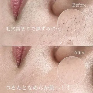 Cher《シェール》 なぎさの眉毛・アイブロウイメージ