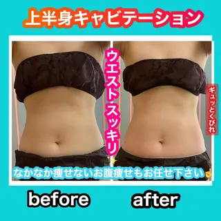 痩身/脱毛/ネイル HARUKAのエステ・リラクイメージ