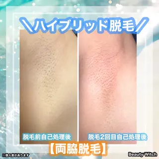 痩身/脱毛/ネイル HARUKAのエステ・リラクイメージ