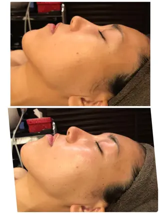 y.laBelle所属・y.laBelle 艶肌・小顔・肌質改善のエステ・リラクイメージ