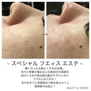 ビューティー ミロワールのエステ・リラクイメージ