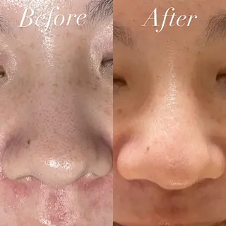 プライベートサロン Belle（ベル）のエステ・リラクイメージ