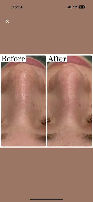 美肌脱毛サロン muroのエステ・リラクイメージ