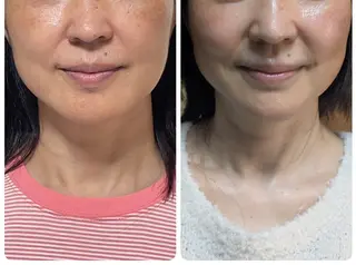 フェイシャルエステ アンソン・ドゥのエステ・リラクイメージ