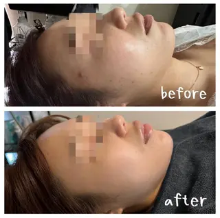 医療提携サロン新宿 La Lunaのエステ・リラクイメージ