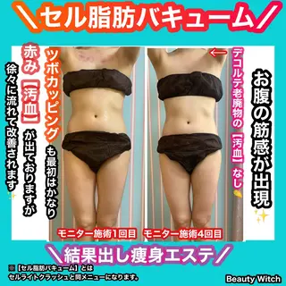 痩身/脱毛/ネイル HARUKAのエステ・リラクイメージ