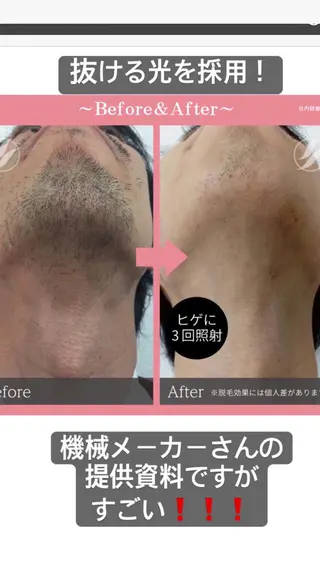 美肌脱毛fuu okinawa所属・宜野湾美肌脱毛fuu okinawaタイラのエステ・リラクイメージ