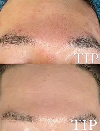 パーソナル肌質改善 🦋APRI🅿️有のエステ・リラクイメージ