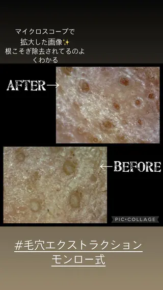 o3remedy所属・宇野澤 彩加のエステ・リラクイメージ