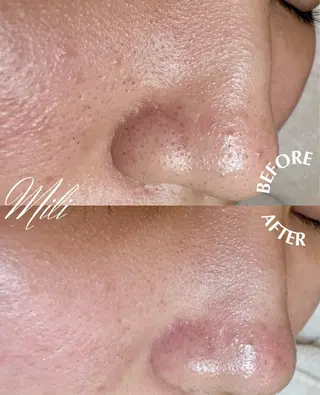 毛穴専門店 mili柏のエステ・リラクイメージ