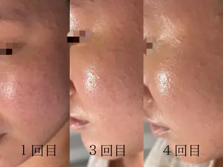 lumirise所属・lumi riseのエステ・リラクイメージ