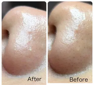 Frele Komiのエステ・リラクイメージ