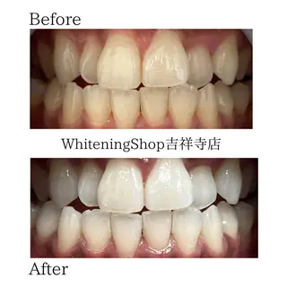 ホワイトニング ショップ吉祥寺店のエステ・リラクイメージ