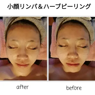 未病ケアサロン　EMINY所属・未病ケアサロン EMINY☺︎勝俣のエステ・リラクイメージ