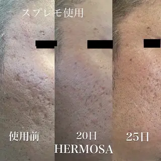 オールハンド フェイシャルのエステ・リラクイメージ