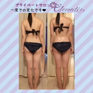 ショート カラー パーマ ヘアアレンジ メンズ キッズ ネイル マツエク・マツパ 強圧オールハンド痩身&黄土よもぎ蒸しプライベートサロンClematis池袋所属・強圧オールハンド痩身 片野のエステ・リラクイメージ