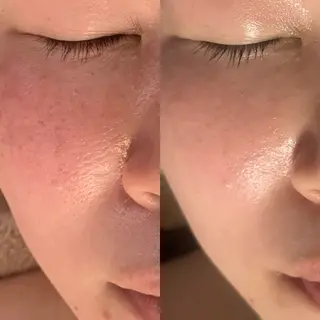 MEREA  personal esthe所属・感動的オーダーメイド エステMEREAのエステ・リラクイメージ