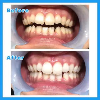 Mon Cheri 広島店のエステ・リラクイメージ