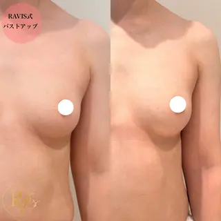 beautysalon RAVIS所属・東大阪/韓国肌管理/ 痩身バスト専門店のエステ・リラクイメージ