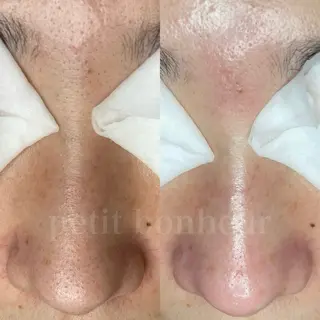 槙谷 あさみのエステ・リラクイメージ