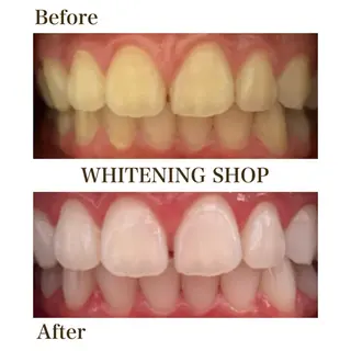 セルフホワイトニングショップ静岡葵区店所属・もえか静岡葵区店ホ ワイトニングショップのその他イメージ