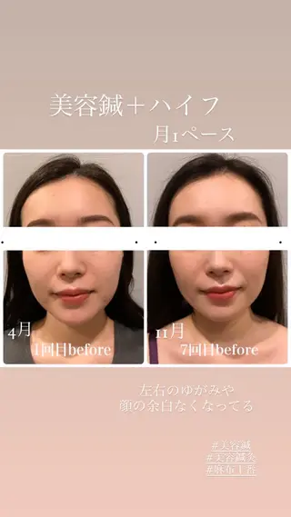 種市 貴子のその他イメージ