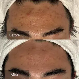 メンズ 【メンズ脱毛・美肌】 SARA 恵比寿店のエステ・リラクイメージ