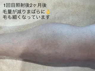 Beauty salon dessert（ビューティーサロンデザート）所属・板垣 あゆみのエステ・リラクイメージ