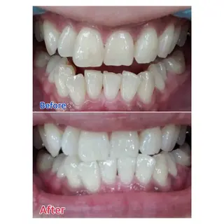 MBEAUTYSALON 千葉店・京成大久保所属・Melty 輝のその他イメージ