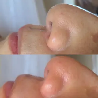 Premier 所属・艶肌Wax新宿３丁目 &巻き爪矯正のエステ・リラクイメージ