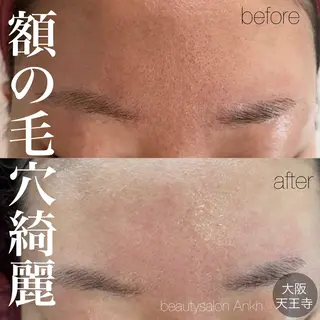 【しみ毛穴専門店】beautysalon Ankh所属・しみ毛穴専門店 Ankh 平田のエステ・リラクイメージ