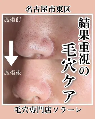  毛穴洗浄・まつ毛 の専門店 ソラーレのエステ・リラクイメージ